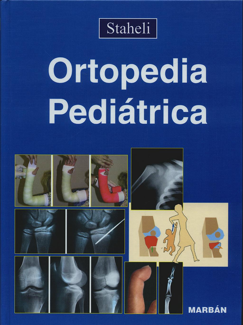 Portada del libro 9788471013972 Ortopedia Pediátrica