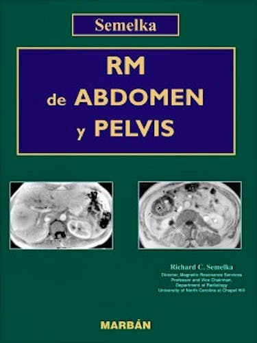 Portada del libro 9788471014252 RM de Abdomen y Pelvis, 2 Vols.