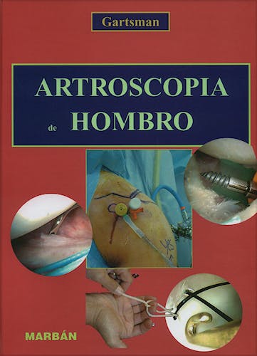 Portada del libro 9788471014443 Artroscopia de Hombro