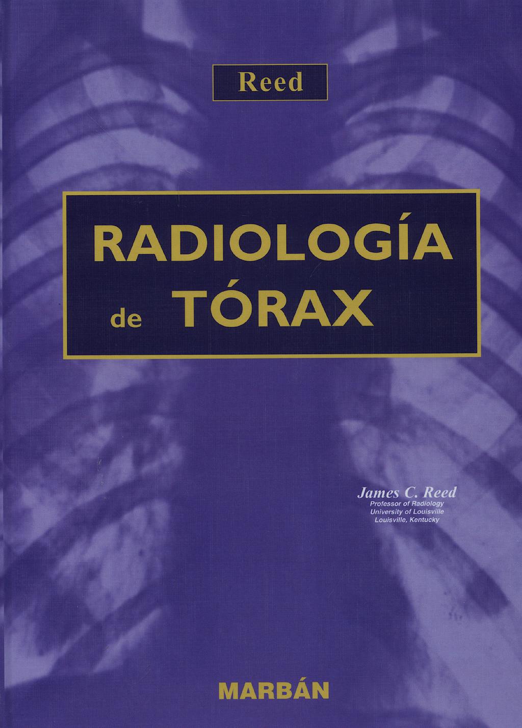 Portada del libro 9788471014689 Radiología de Tórax