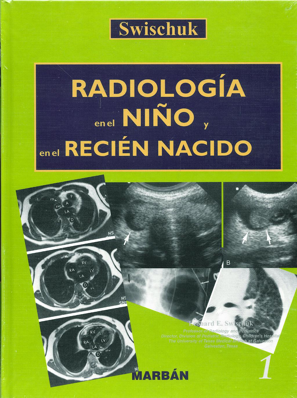 Portada del libro 9788471014733 Radiologia en el Niño y en el Recien Nacido, 2 Vols.