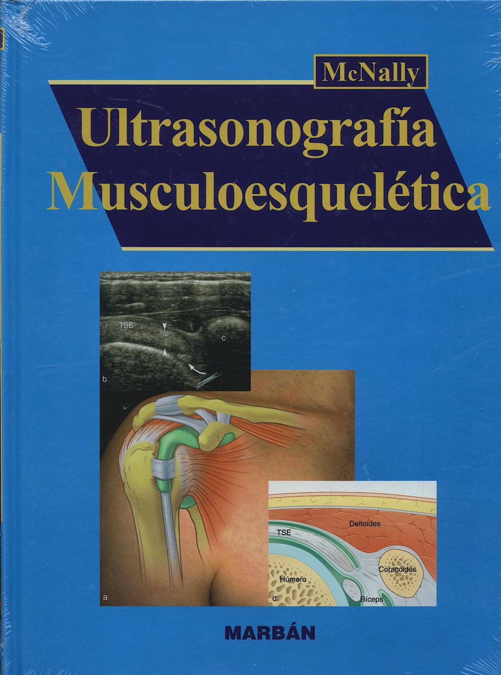 Portada del libro 9788471014764 Ultrasonografia Musculoesqueletica
