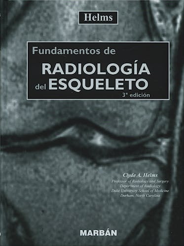 Portada del libro 9788471015044 Fundamentos de Radiología del Esqueleto