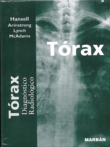 Portada del libro 9788471015105 Tórax. Diagnóstico Radiológico. Edición Premium