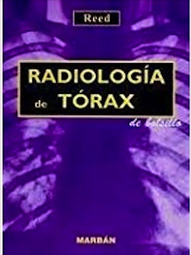 Portada del libro 9788471015266 Radiología de Tórax de Bolsillo