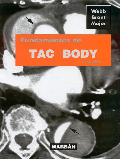 Portada del libro 9788471015730 Fundamentos de Tac Body (Edición Premium)