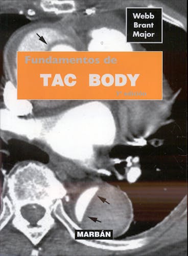 Portada del libro 9788471015747 TAC Body (Edición Pocket)