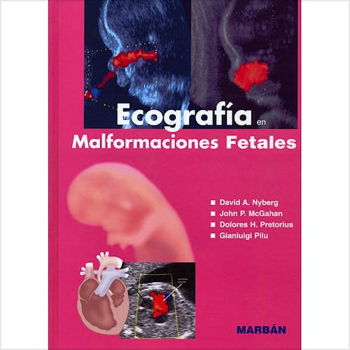 Portada del libro 9788471015914 Ecografía en Malformaciones Fetales (Flexilibro)