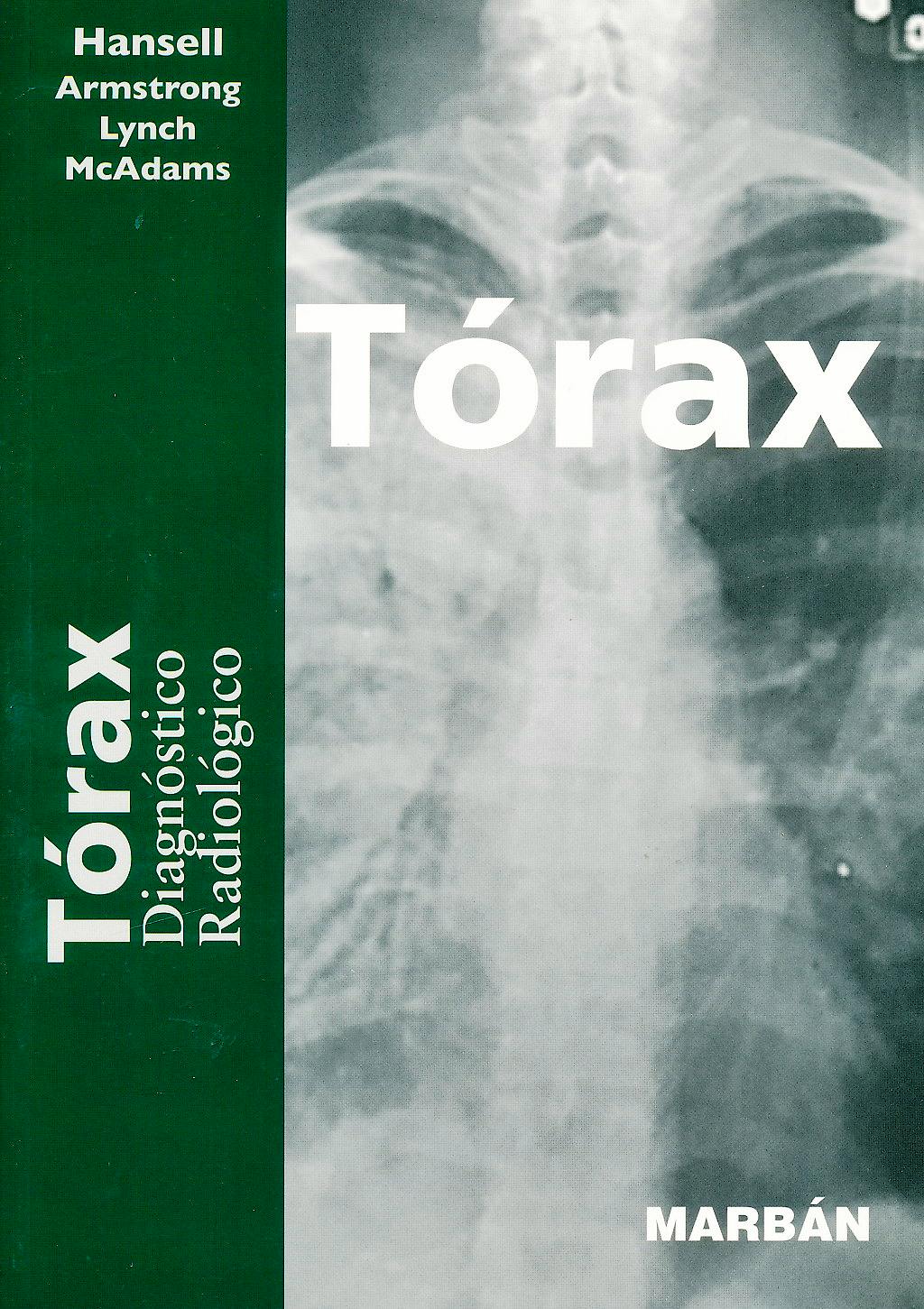 Portada del libro 9788471015921 Torax. Diagnostico Radiologico (Formato 17 "Residentes")