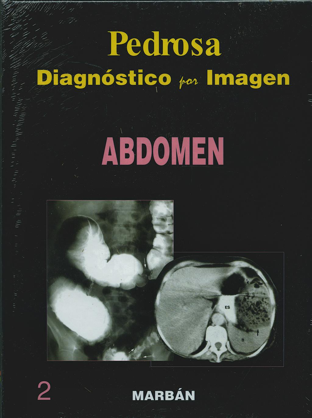 Portada del libro 9788471015945 Diagnóstico por Imagen, Vol. 2: Abdomen (Tapa Dura)