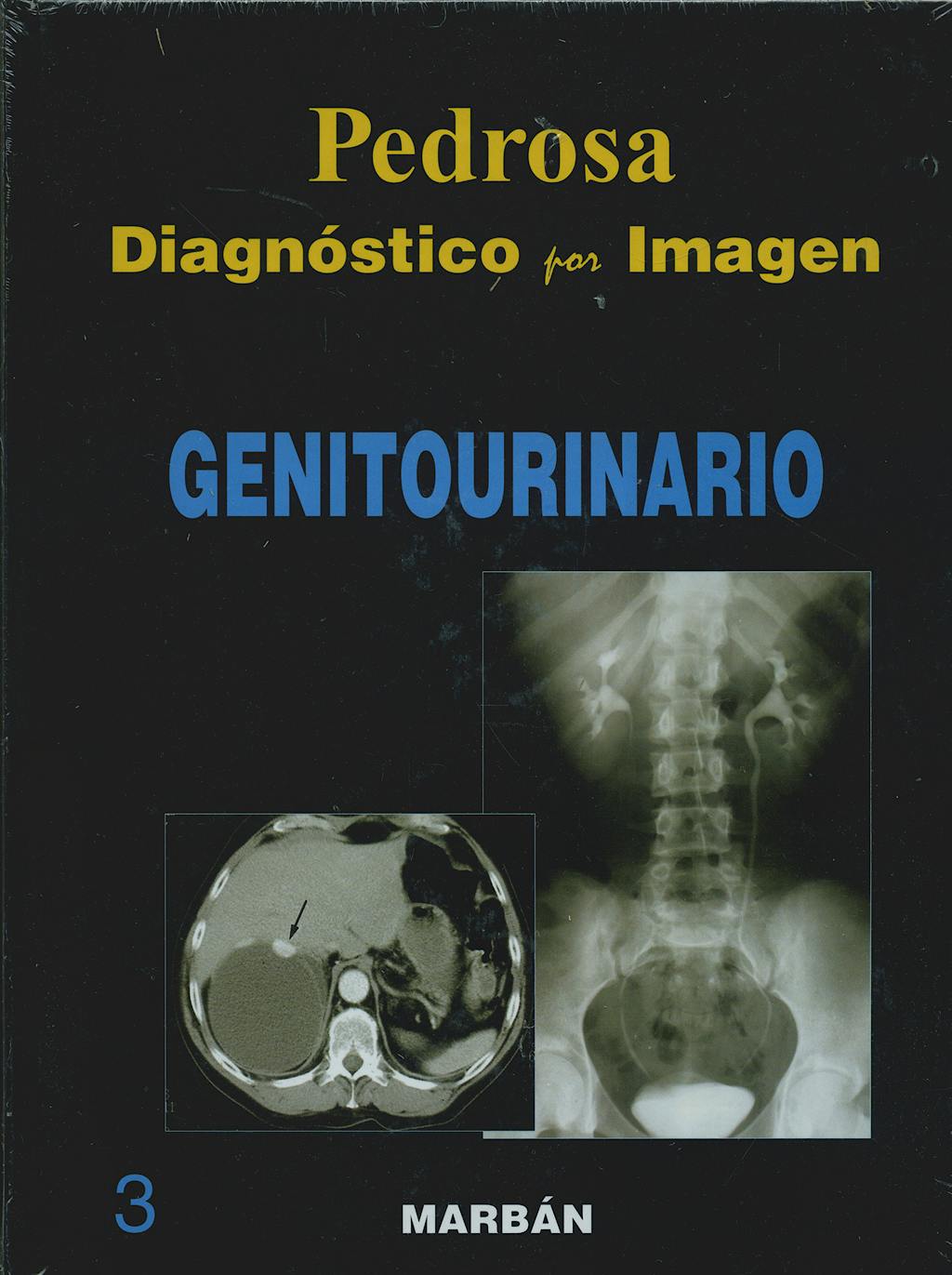 Portada del libro 9788471015952 Diagnóstico por Imagen, Vol. 3: Genitourinario (Tapa Dura)