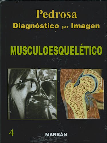 Portada del libro 9788471015969 Diagnóstico por Imagen, Vol. 4: Musculoesquelético (Tapa Dura)