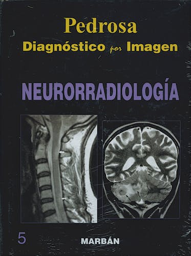 Portada del libro 9788471015976 Diagnóstico por Imagen, Vol. 5: Neurorradiología (Tapa Dura)