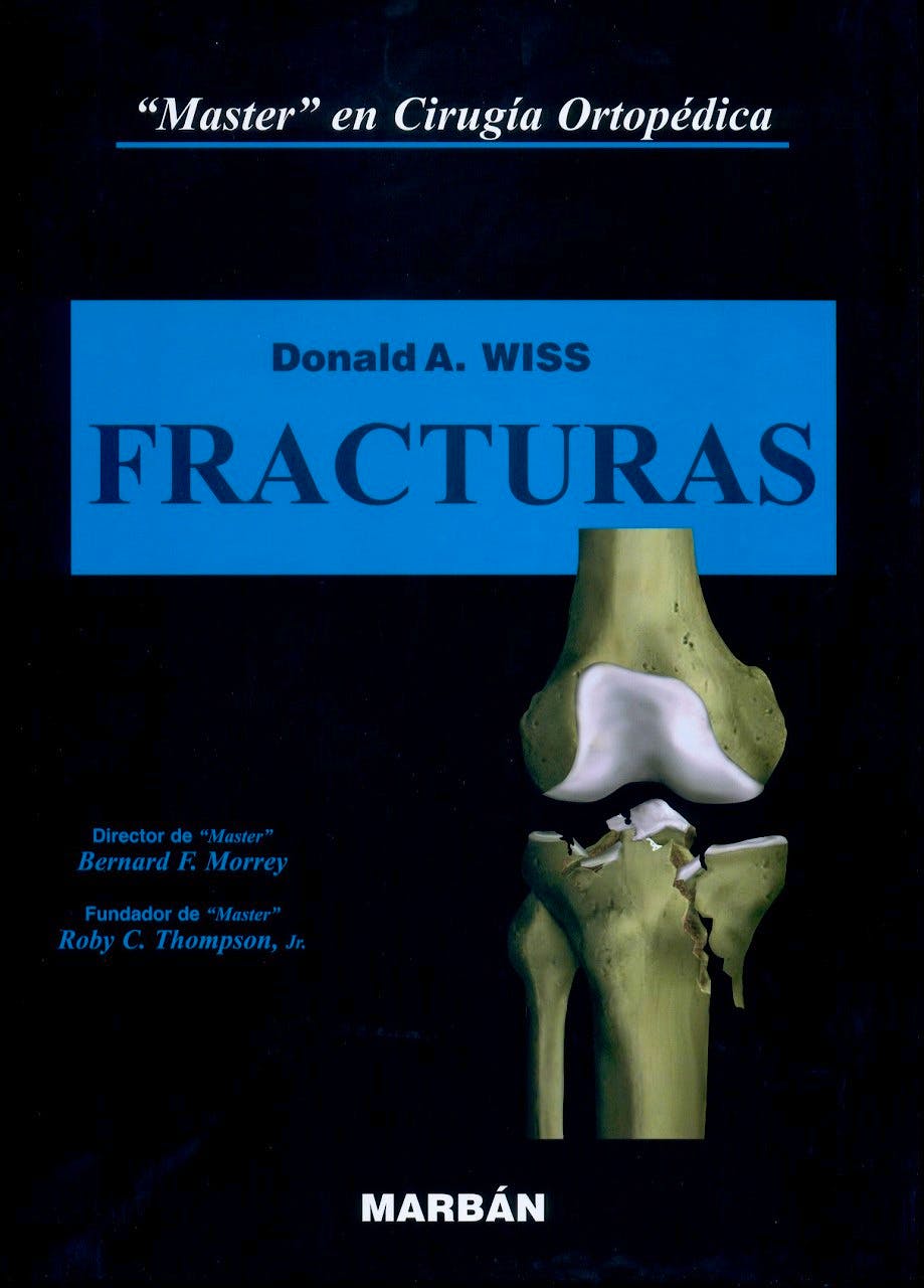 Portada del libro 9788471016478 Master en Cirugía Ortopédica: Fracturas (Flexilibro)