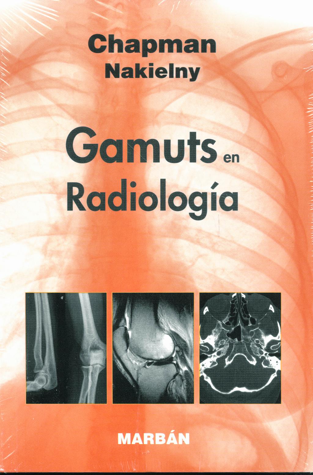 Portada del libro 9788471016553 Gamuts en Radiologia (Edicion Bolsillo)