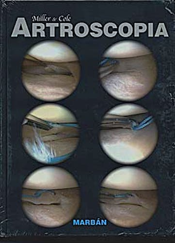 Portada del libro 9788471017086 Artroscopia (Tapa Dura)