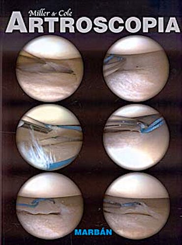 Portada del libro 9788471017093 Artroscopia