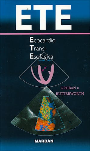 Portada del libro 9788471017130 ETE Ecocardio Transesofágica