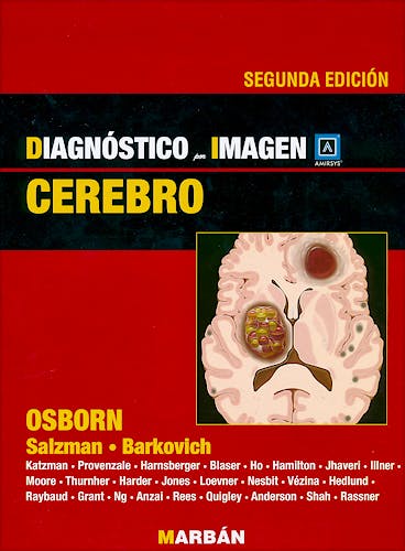 Portada del libro 9788471017208 Diagnóstico por Imagen: Cerebro