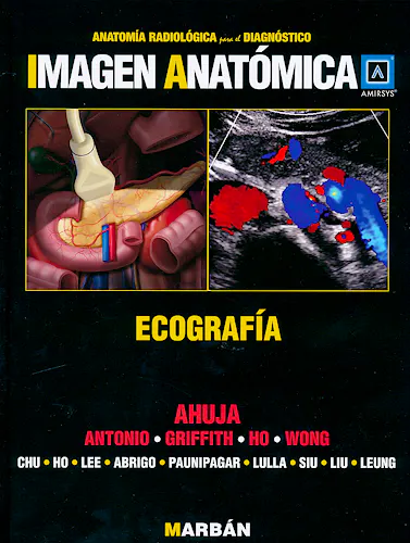 Portada del libro 9788471017253 Imagen Anatómica: Ecografía (Anatomía Radiológica para el Diagnóstico)
