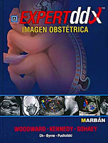 Portada del libro 9788471017277 Expert DDX: Imagen Obstétrica