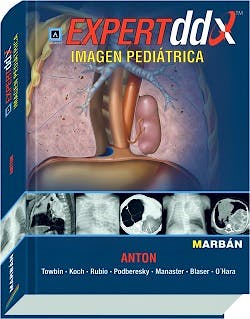 Portada del libro 9788471017284 Expert DDX: Imagen Pediátrica