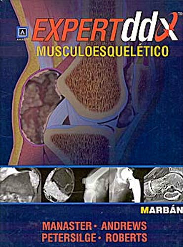 Portada del libro 9788471017314 Expert DDX: Musculoesquelético