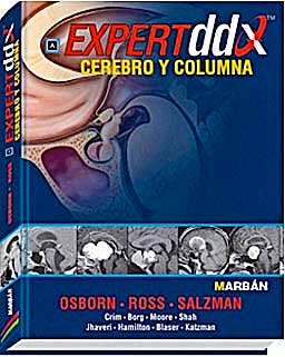 Portada del libro 9788471017321 Expert DDX: Cerebro y Columna