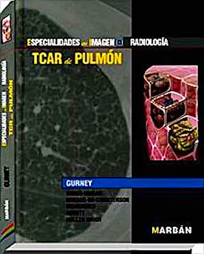 Portada del libro 9788471017482 TCAR de Pulmón (Especialidades en Imagen: Radiología)