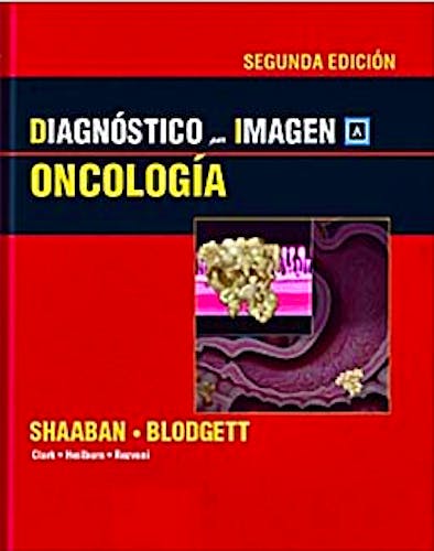Portada del libro 9788471017567 Diagnóstico por Imagen: Oncología
