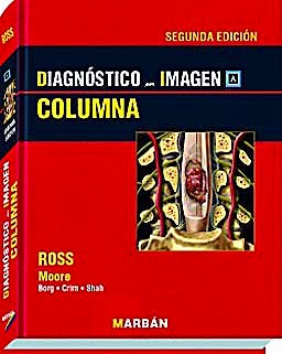 Portada del libro 9788471017604 Diagnóstico por Imagen: Columna