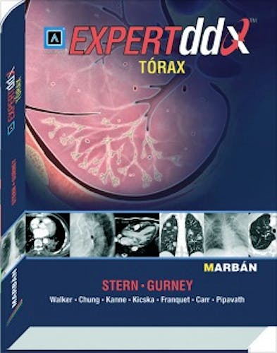 Portada del libro 9788471017741 Expert DDX: Tórax