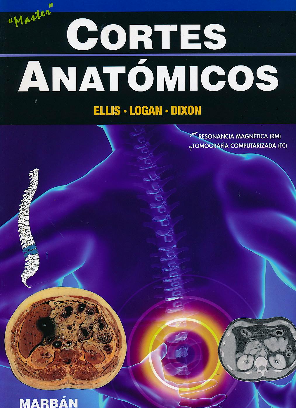 Portada del libro 9788471018205 Cortes Anatómicos con Resonancia Magnética y Tomografía Computerizada. Master