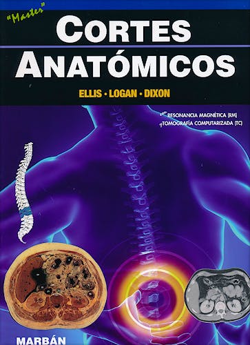 Portada del libro 9788471018205 Cortes Anatómicos con Resonancia Magnética y Tomografía Computerizada. Master