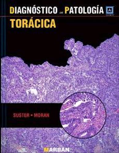 Portada del libro 9788471018373 Diagnóstico en Patología: Torácica