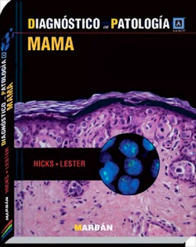 Portada del libro 9788471018397 Diagnóstico en Patología: Mama