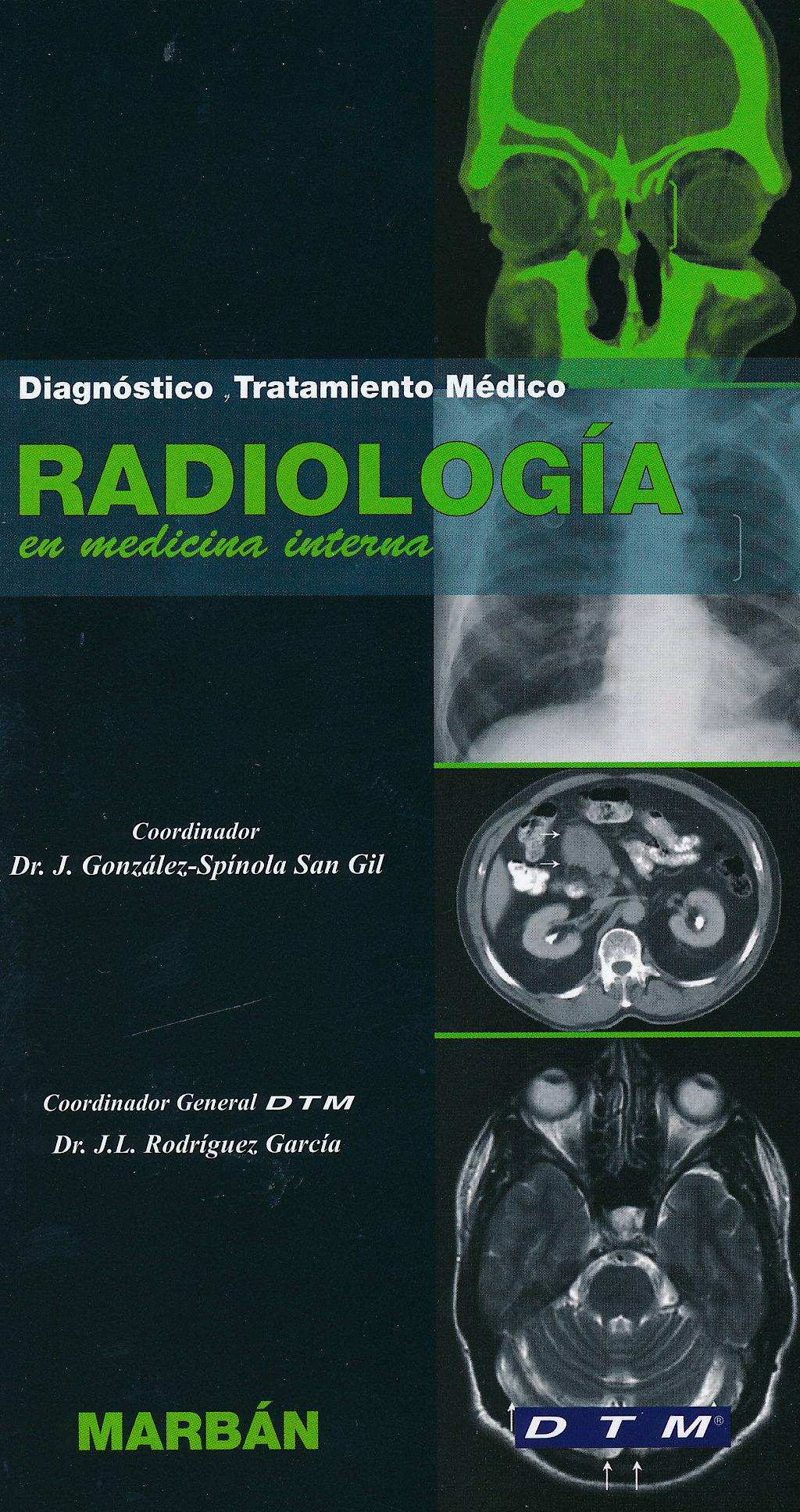 Portada del libro 9788471018496 Radiología en Medicina Interna. Diagnóstico y Tratamiento Médico DTM
