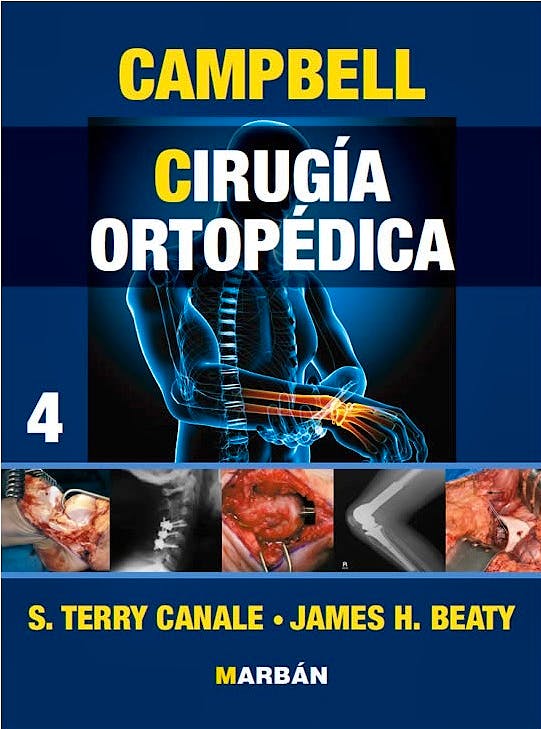 Portada del libro 9788471018915 Campbell Cirugía Ortopédica, Vol. 4 (Bibliografía de la Obra)