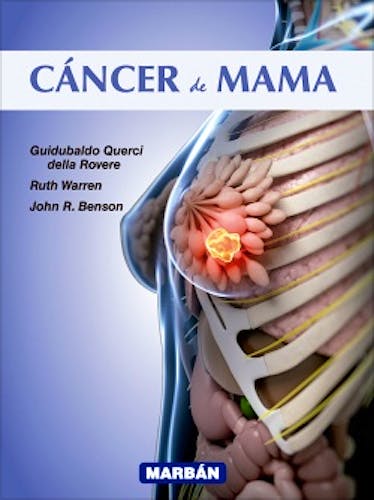 Portada del libro 9788471019561 Cancer de Mama
