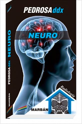 Portada del libro 9788471019660 Pedrosa ddx: Neuro