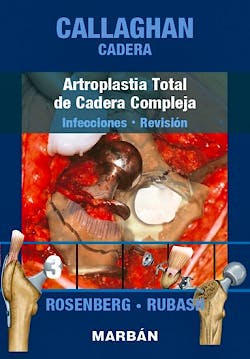 Portada del libro 9788471019974 Callaghan Cadera, Tomo 3: Artroplastia Total de Cadera Compleja. Infecciones, Revisión