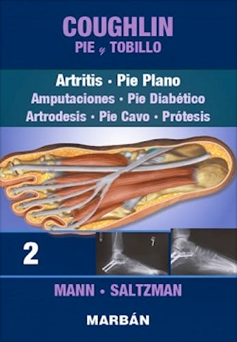 Portada del libro 9788471019998 COUGHLIN Pie y Tobillo, Tomo 2: Artritis. Pie Plano. Amputaciones, Pie Diabético, Artrodesis, Pie Cavo, Prótesis