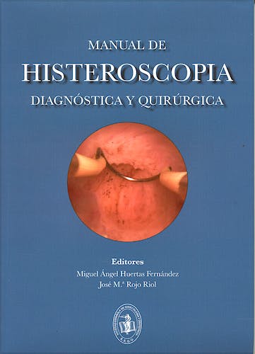 Portada del libro 9788474293661 Manual de Histeroscopia Diagnóstica y Quirúrgica