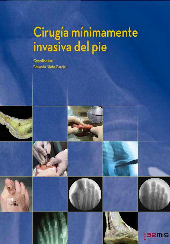 Portada del libro 9788474296600 Cirugía Mínimamente Invasiva del Pie