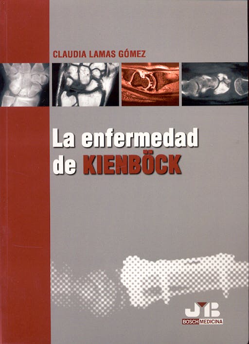 Portada del libro 9788476987407 La Enfermedad de Kienböck