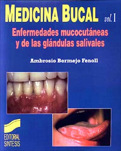 Portada del libro 9788477385578 Medicina Bucal, Vol. 1. Enfermedades Mucocutáneas y de las Glándulas Salivales