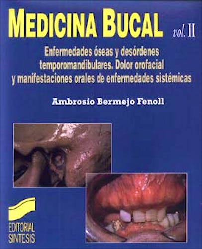 Portada del libro 9788477385585 Medicina Bucal, Vol. 2. Enfermedades Óseas y Desórdenes Temporomandibulares. Dolor Orofacial y Manifestaciones Orales de Enfermedades Sistémicas