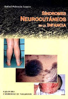 Portada del libro 9788477628064 Síndromes Neurocutáneos en la Infancia