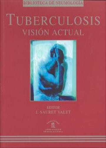 Portada del libro 9788478852611 Tuberculosis. Vision Actual