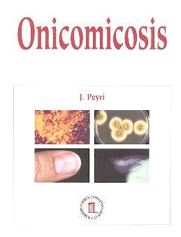 Portada del libro 9788478852864 Onicomicosis
